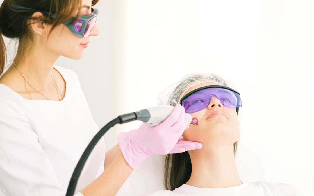 Laser Treatment Costs in Bethesda, Maryland for Sun Damage and Skin Texture